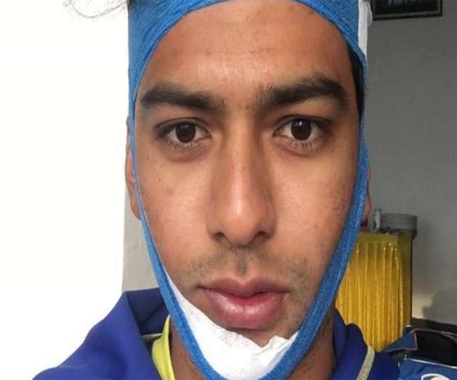 Vijay Hazare Trophy Unmukt Chand broken jaw