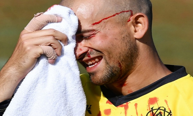 WATCH लाइव मैच में एश्टन एगर  के साथ घटी घटना, हुए लहुलुहान, मैदान पर ही गिर पड़े ! Images
