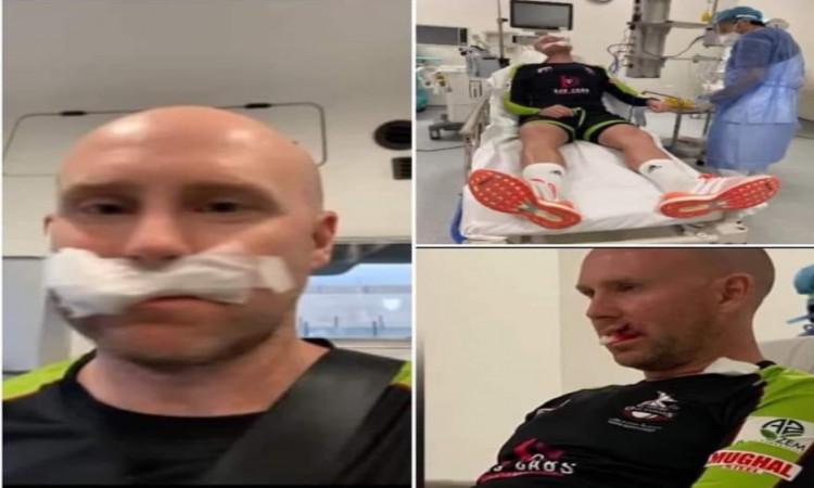 PSL 2021: Lahore Qalandars keeper Ben Dunk injured, receives seven stitches