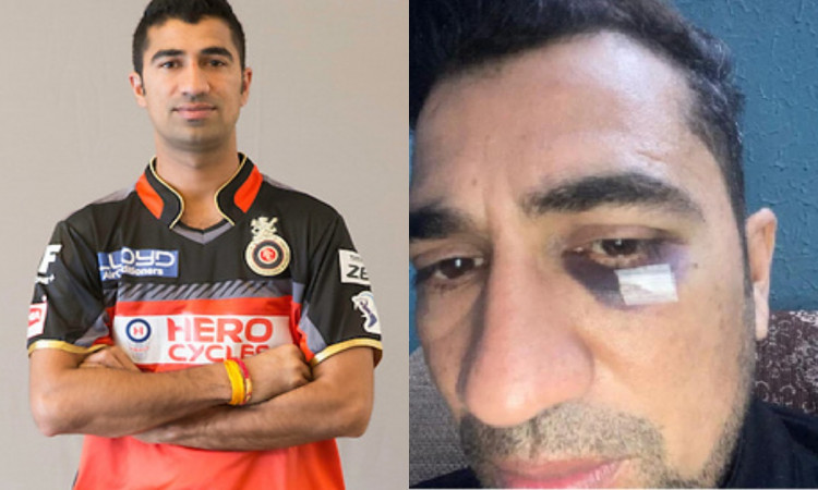 आरसीबी के पूर्व क्रिकेटर को पड़ा पुलिसवाले का घूसा, आंख फूटने से बची