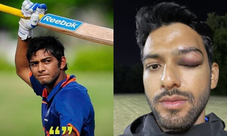 Cricket Image for Unmukt Chand: पूर्व भारतीय कप्तान की आंख पर लगी गंभीर चोट, खुद शेयर की दर्दनाक तस्