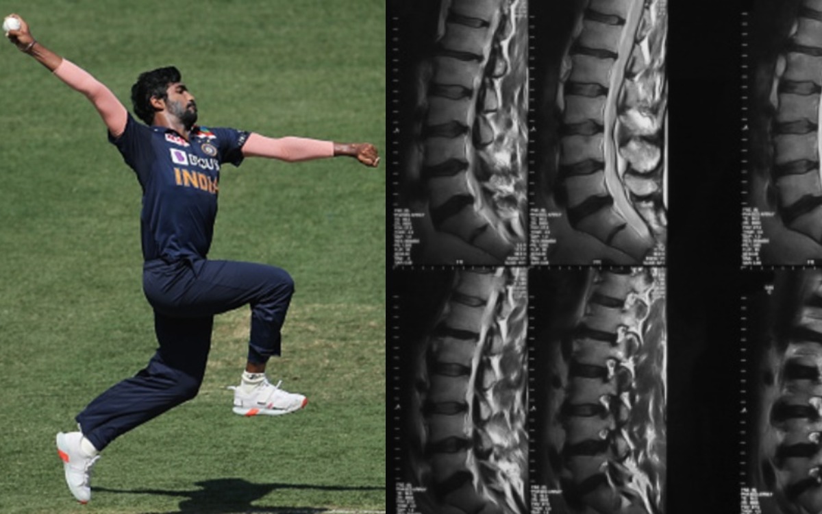 Cricket Image for Jasprit Bumrah News When Will He Return What Is Stress Fracture