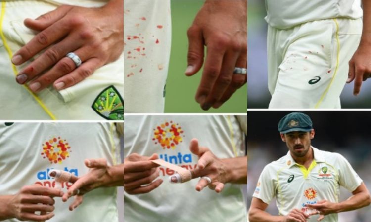 Cricket Image for Mitchell Starc Bowling Through The Pain