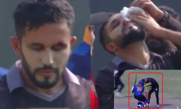 Cricket Image for मोहम्मद हारिस को हीरोगिरी पड़ी भारी, आखें के पास लगी गंभीर चोट; देखें VIDEO