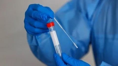 International Testing Agency: World Aquatics releases 2022 testing report