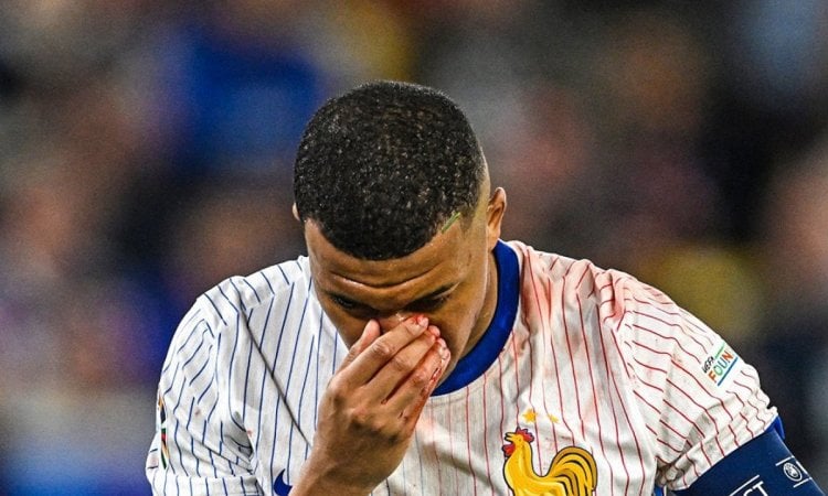 Euro 2024: France's Mbappe may miss remaining Group Stage games following nose injury: Report