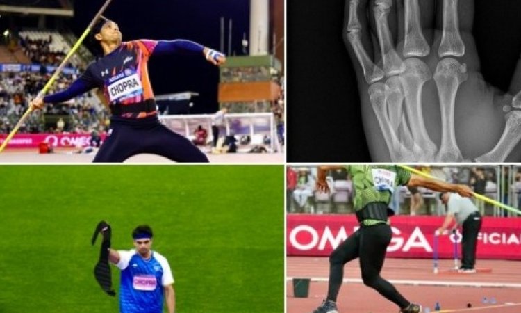 Neeraj Chopra competed in the Diamond League Final with fractured left hand