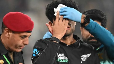 NZ vs AUS: रचिन रविंद्र चेहरे पर गंभीर चोट के कारण ऑस्ट्रेलिया T20I सीरीज से बाहर, पहले ही 7 स्टार ख