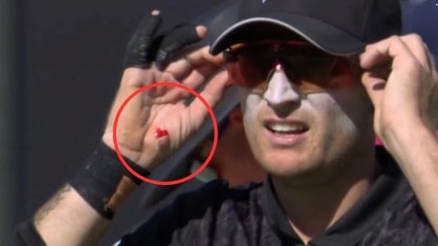 WATCH: विराट कोहली के करारे स्ट्रेट ड्राइव को रोकने की कोशिश में घायल हुए जेडन लेनॉक्स, हथेली से बहन